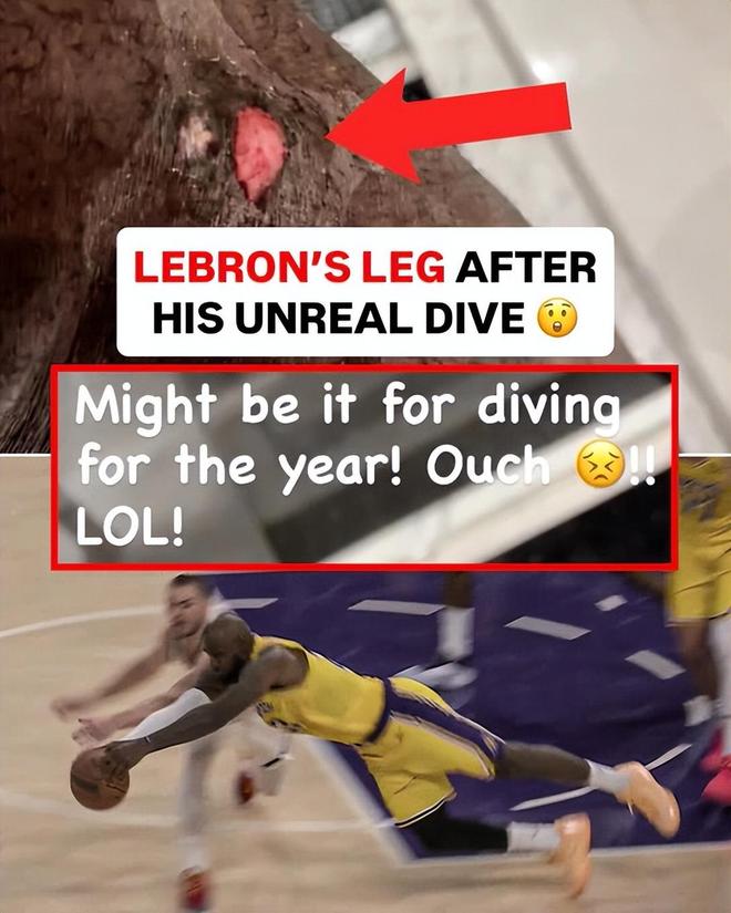 勒布朗·詹姆斯腿部受伤调侃救球结束 东契奇当